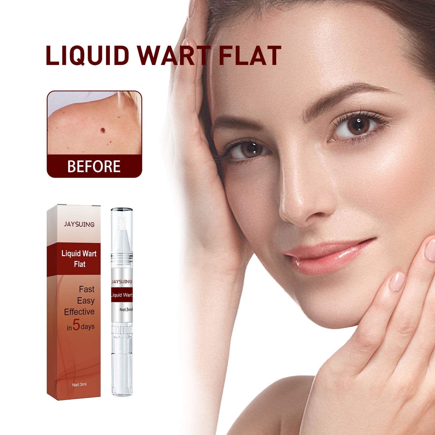 đ„Last Day Promotion 65% OFFđ„Tags & Moles Remover