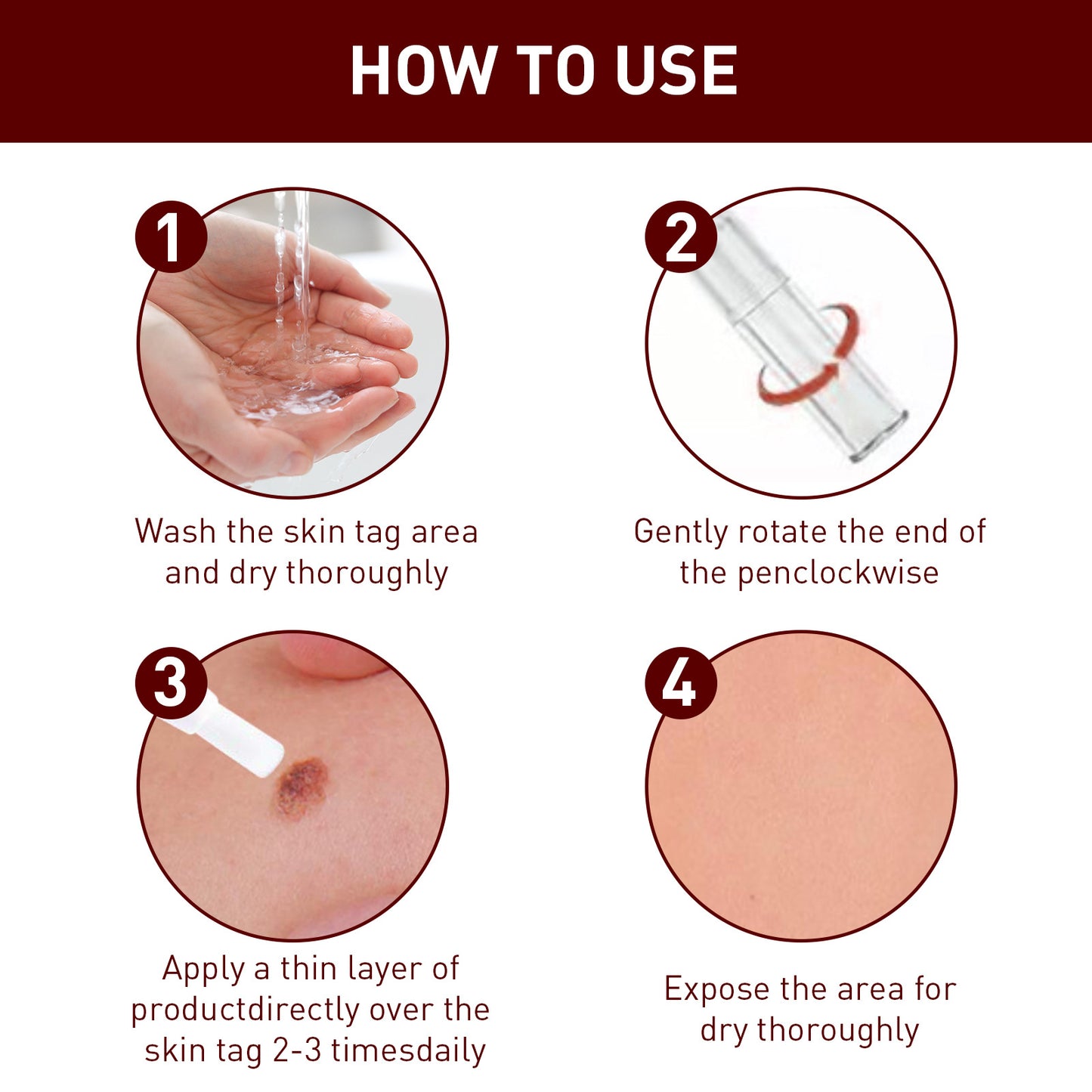 đ„Last Day Promotion 65% OFFđ„Tags & Moles Remover
