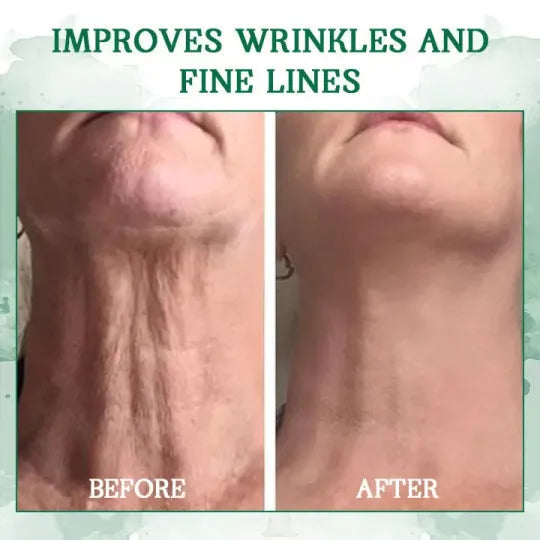 🔥👩⚕️Last Day Promotion 𝟕𝟎%𝐎𝐅𝐅 - SkinFirming Rejuvenating Serum🔥