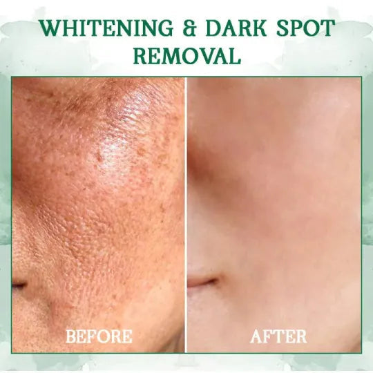 🔥👩⚕️Last Day Promotion 𝟕𝟎%𝐎𝐅𝐅 - SkinFirming Rejuvenating Serum🔥