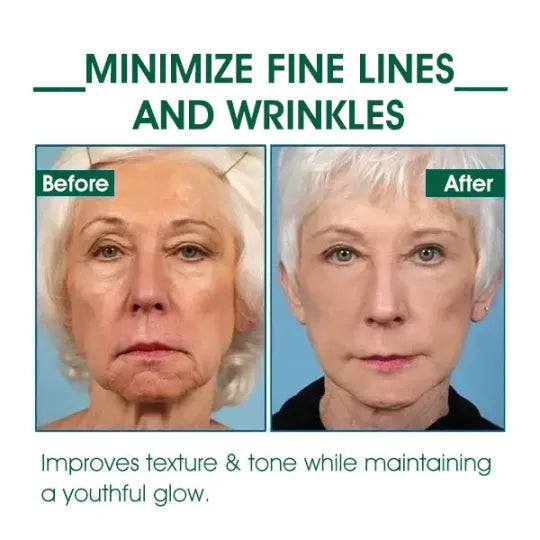 🔥👩⚕️Last Day Promotion 𝟕𝟎%𝐎𝐅𝐅 - SkinFirming Rejuvenating Serum🔥