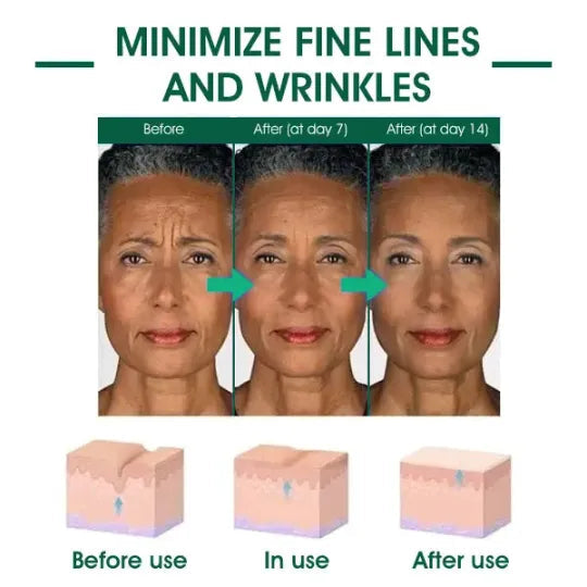 🔥👩⚕️Last Day Promotion 𝟕𝟎%𝐎𝐅𝐅 - SkinFirming Rejuvenating Serum🔥