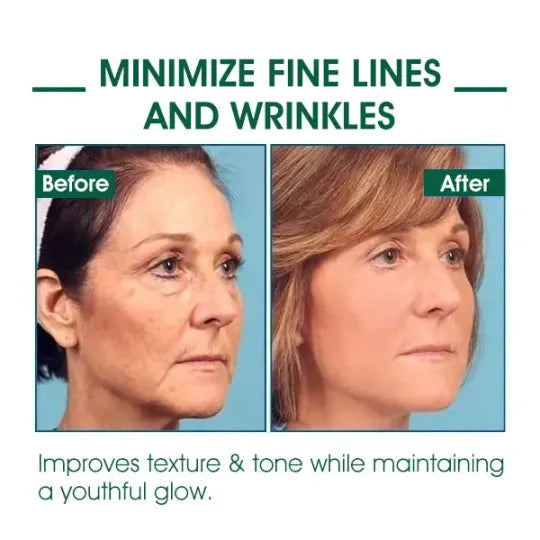 🔥👩⚕️Last Day Promotion 𝟕𝟎%𝐎𝐅𝐅 - SkinFirming Rejuvenating Serum🔥