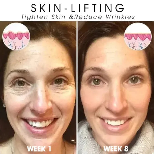 🔥👩⚕️Last Day Promotion 𝟕𝟎%𝐎𝐅𝐅 - SkinFirming Rejuvenating Serum🔥