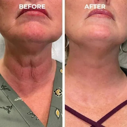 🔥👩⚕️Last Day Promotion 𝟕𝟎%𝐎𝐅𝐅 - SkinFirming Rejuvenating Serum🔥
