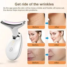 Intelligent V-Face Lifting Massager | 1 Year Warranty 🔥Free shipping Today🔥