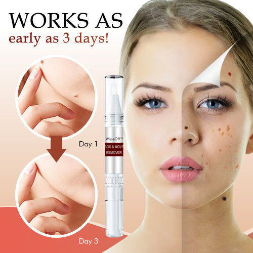 đ„Last Day Promotion 65% OFFđ„Tags & Moles Remover